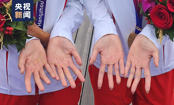 Алтын медаль иегер?н?? м?й?згек бас?ан ала?аны