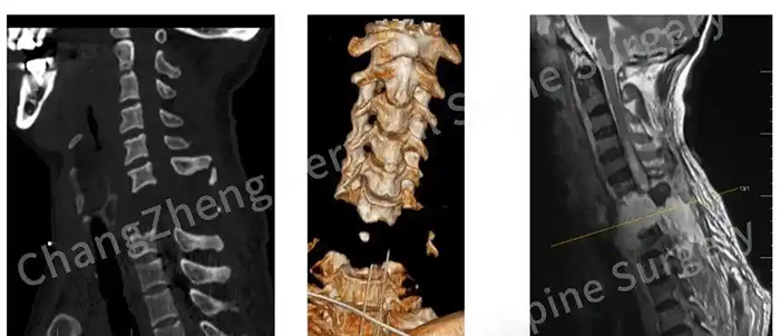 Шанхайлы? д?р?гер мойны ?з?л?п кеткен нау?асты ??т?арды